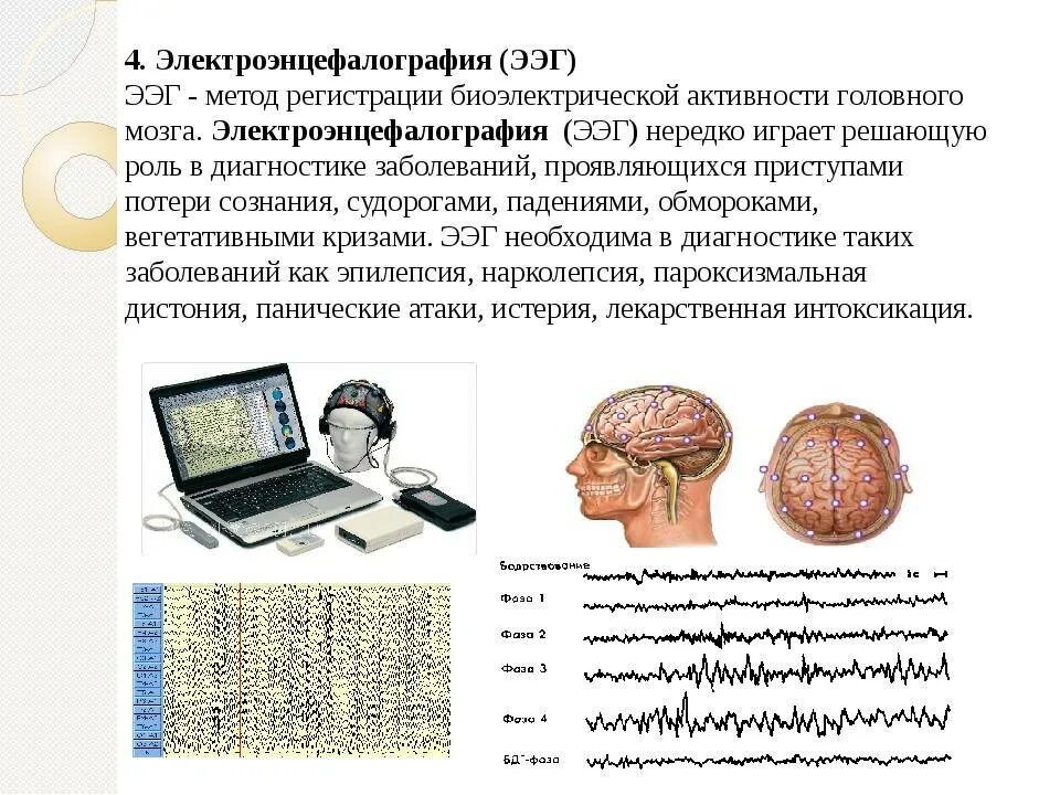 Ээг характеристика. Электроэнцефалография головного мозга (ЭЭГ). ЭЭГ головного мозга методика проведения. ЭЭГ схема физиология. Методика снятия ЭЭГ.