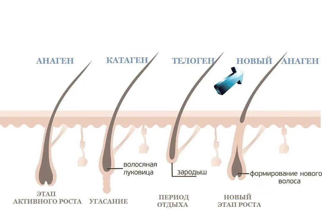 Волосяная луковица. Волосоня луковица. Волос с волосяной луковицей. Как выглядит луковица волоса.