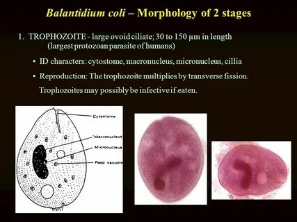 Balantidium coli