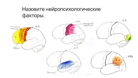 Факторы головного мозга