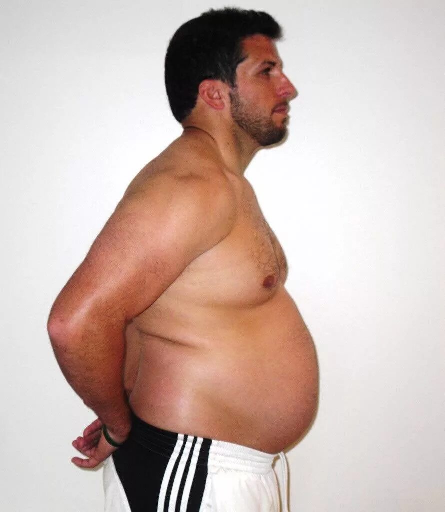 Толстое тело. Дрю Мэннинг потолстел до 120 кг. Дрю Мэннинг толстый. Гордон потолстел.
