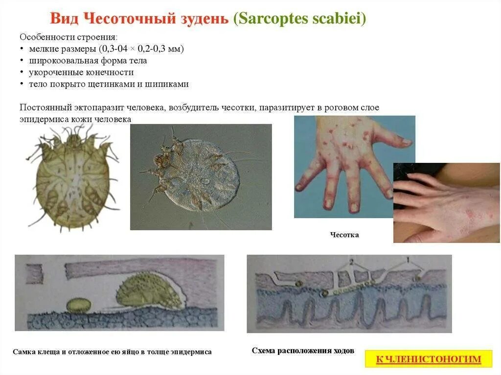 Сколько живет чесоточный. Клещ чесоточный зудень симптомы. Чесоточный зудень (вид Sarcoptes scabiei) х40. Чесоточный зудень (Sarcoptes scabiei). Чесоточный клещ паразит человека.