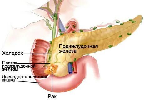 Холедох
