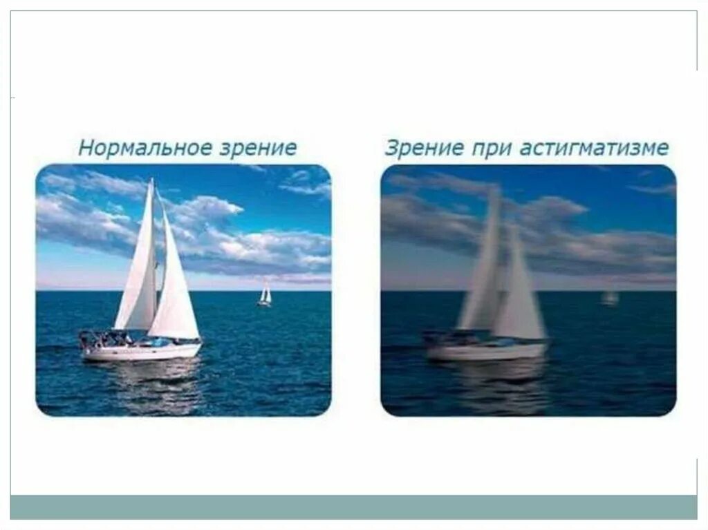 Мир с астигматизмом. Зрение при астигматизме. как видит человек при астигматизме. люди с астигматизмом и без.