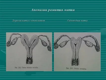 Форма матки