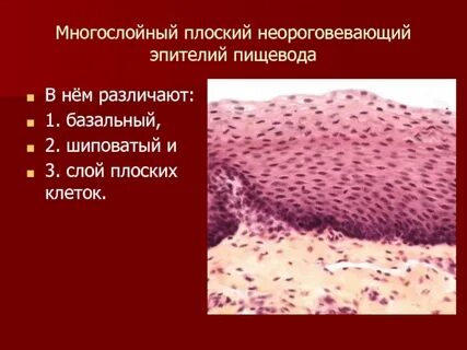 Плоский эпителий без