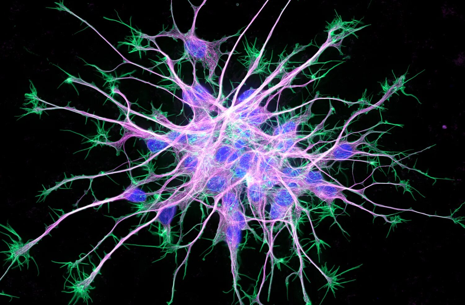 Включает несколько слоев нейронов. Нейрональные стволовые клетки. Нейрон Мартинотти. Гиппокамп Нейроны. Нейроны микроскопия.