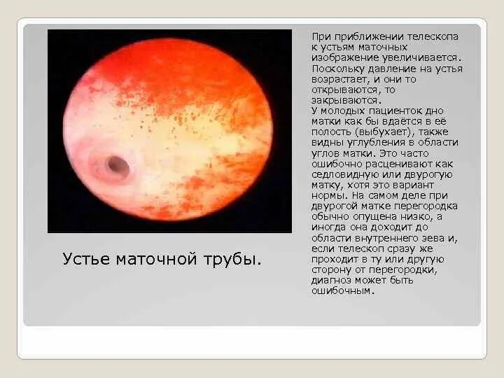 Поджелудочная железа не визуализируется. Гистеросальпингография непроходимость маточных труб. Цдк кровоток щитовидной железы. Узи на 7 день задержки. Субтотальная резекция щитовидной железы на узи.