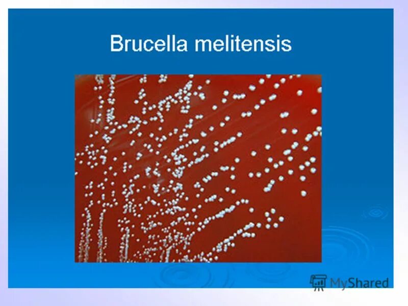 Кольцевая реакция. Brucella Melitensis морфология. Бруцеллы возбудители. Brucella Melitensis микробиологи. Бруцелла мелитензис у человека.