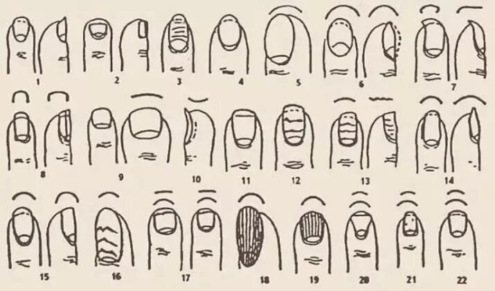 По ногтям определить человеком. Пальцы и формы ногтевой пластины. Болезни по форме ногтей. Виды ногтевых пластин.