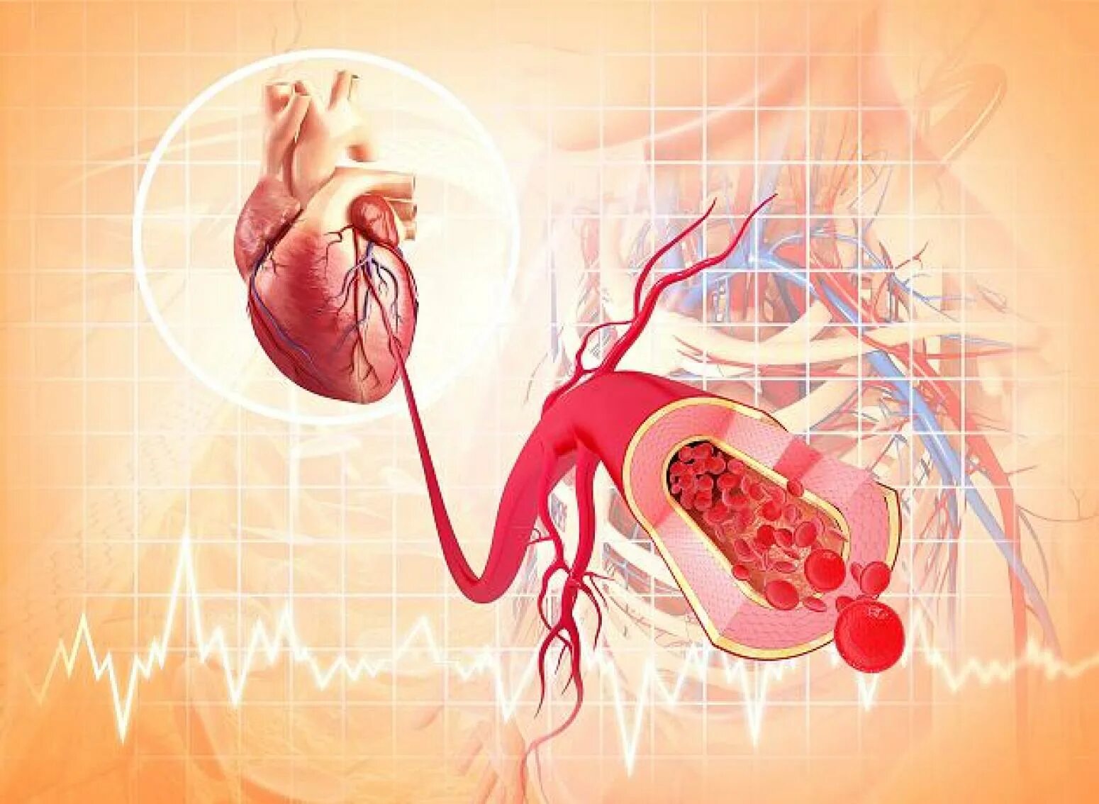 Кардиоваскулярная аритмия сердца. Болезни системы кровообращения. Заболевания сердца и сосудов. Сосуды сердца.