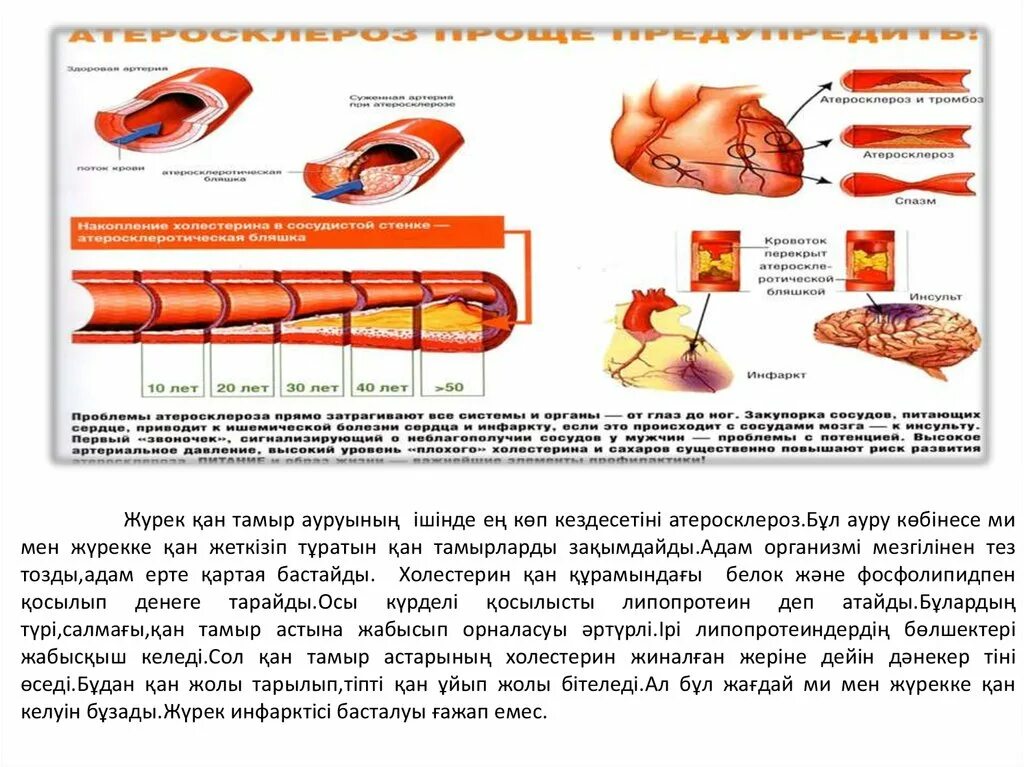 История болезни атеросклеротический