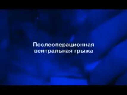 Грыжа екатеринбург