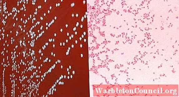 Brucella spp. Бруцелла melitensis. бруцеллы морфология. brucella melitensis микробиология. brucella abortus морфология.