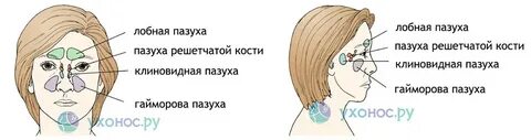 Киста в верхнечелюстной пазухе носа