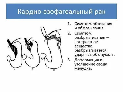 Какой желудок у рака