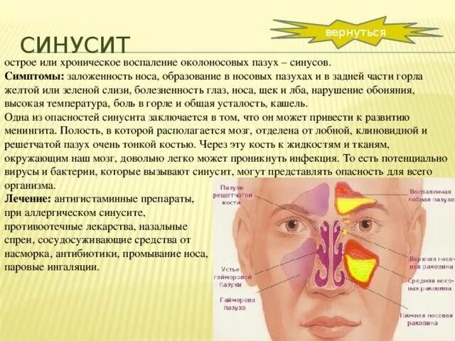 Ноющая боль в лице. Синусит гайморит фронтит. Симптомы острого верхнечелюстного синусита. Острые и хронические синуситы.