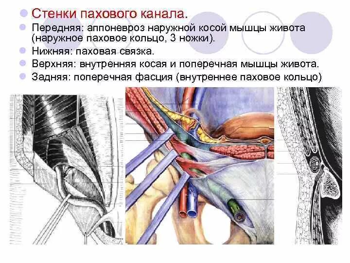 Болит паховая область у мужчин. Паховый канал анатомия стенки. Связки паховой области анатомия. Canalis inguinalis стенки. Поверхностный паховый канал.