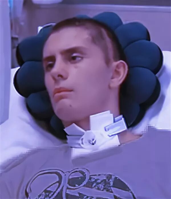 What happens in a TBI? Headway
