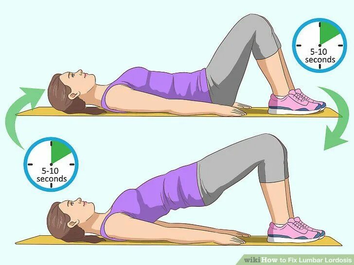 Лордоз упражнения для исправления. Лордоз поясничного отдела упражнения. Лордоз тазобедренного сустава. Поясничный лордоз упражнения. Упражнения для исправления лордоза в пояснице.