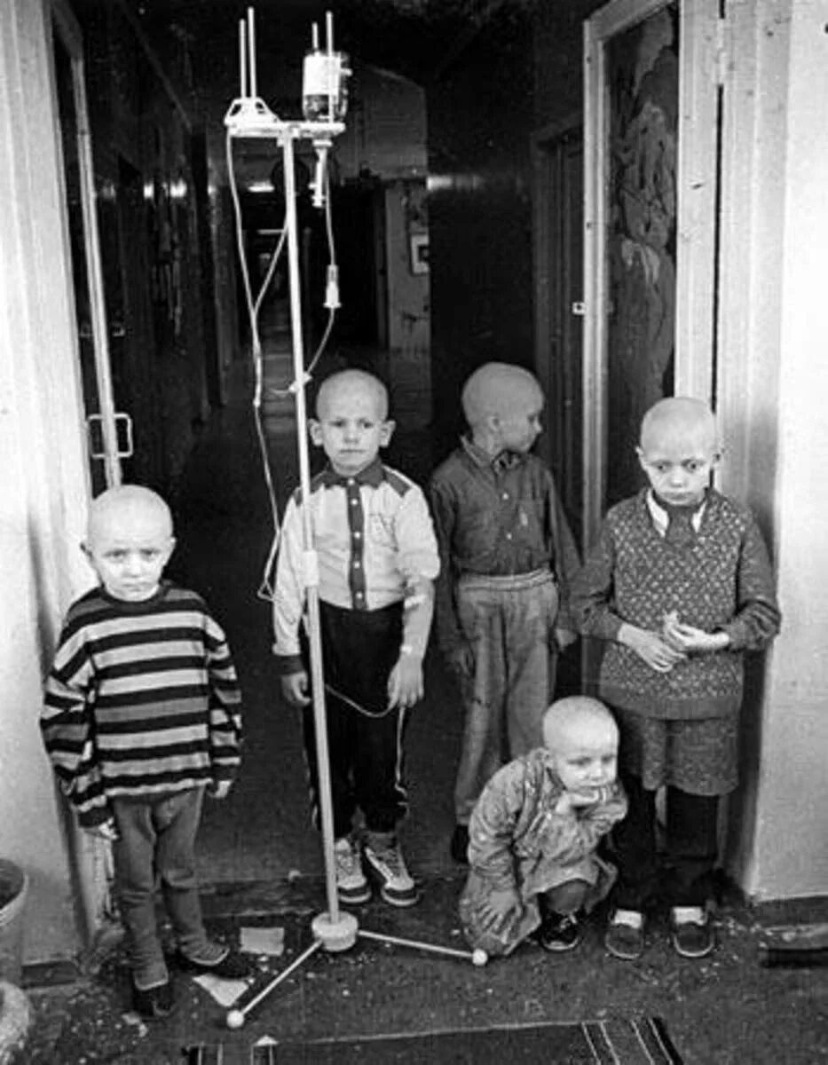 Чернобыльская семья. Мутация после радиации в чернобыли. Чернобыльская аэс мутанты люди. Мутации после чернобыльской катастрофы. Чернобыльская семья.