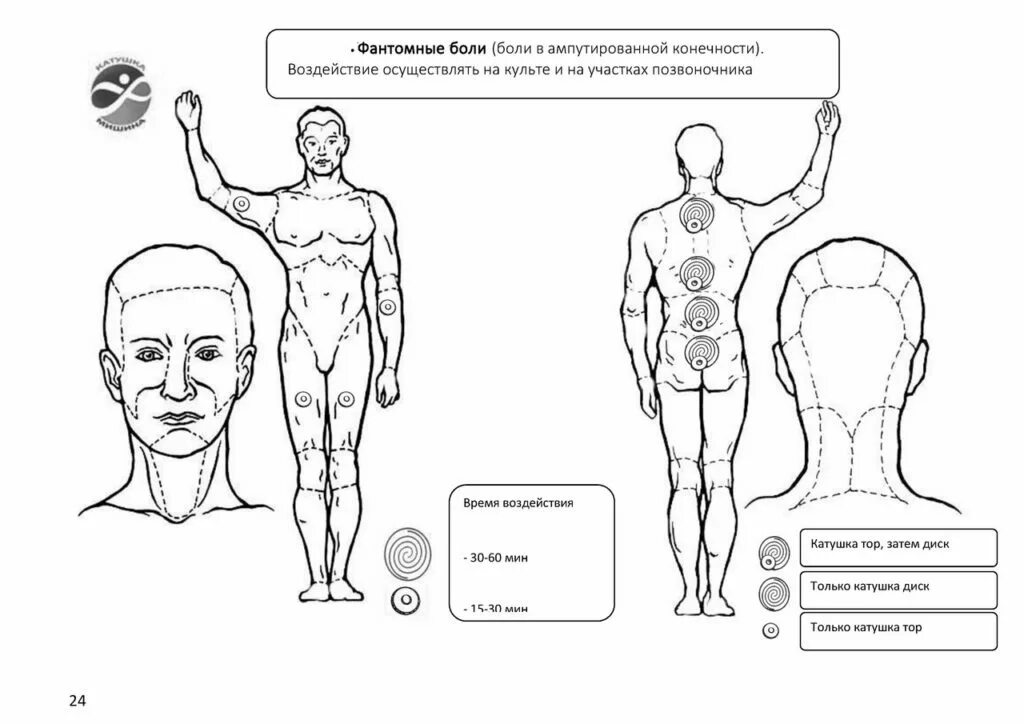 Фантомные боли лечение. Катушка Мишина инструкция. Катушка Мишина инструкция по применению. Катушки Мишина показания. Как пользоваться катушкой Мишина.