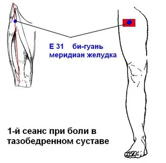 Бедро болит в состоянии покоя