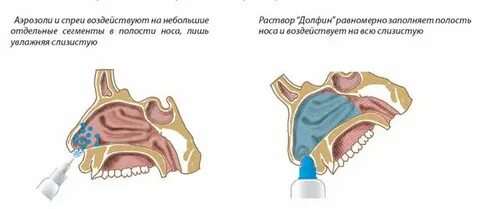 Гайморит что брызгать