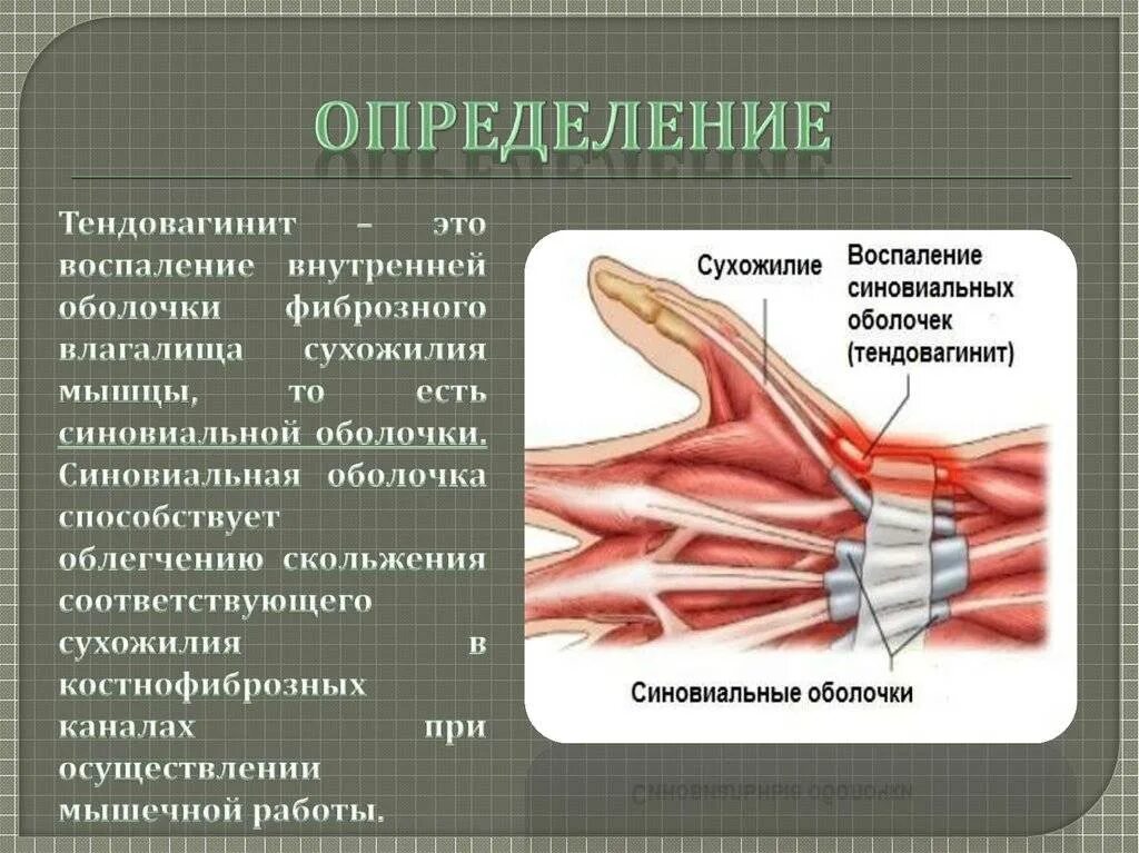 Оболочка мышц сухожилий