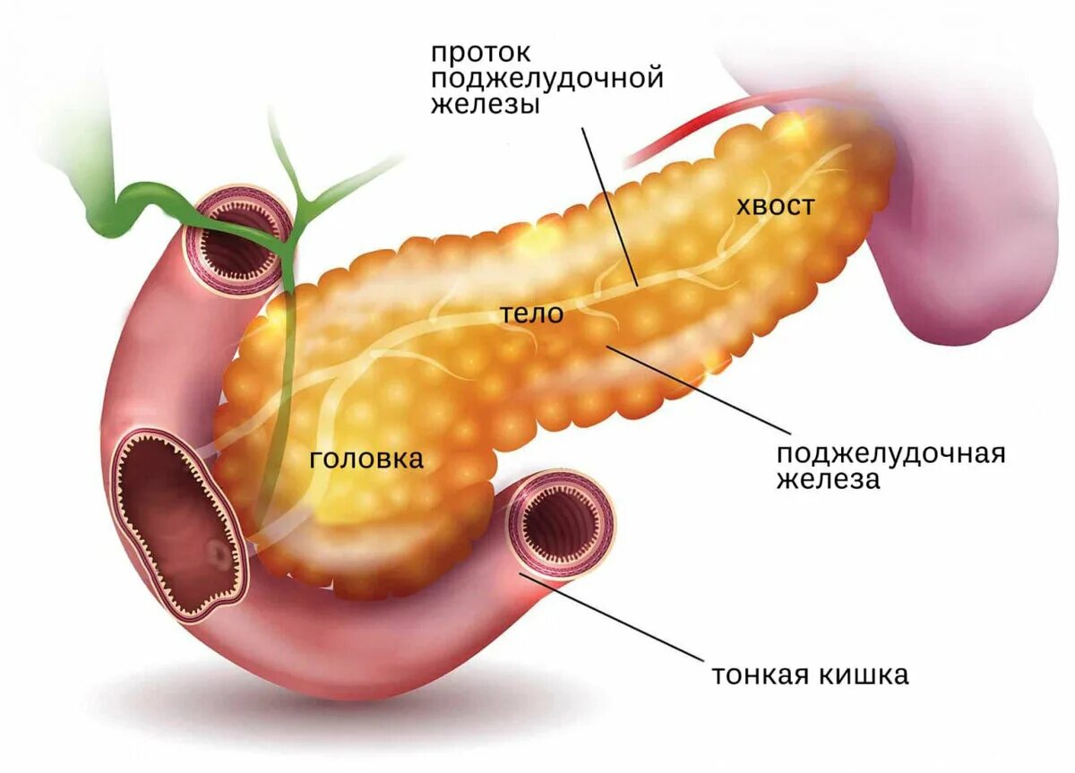 Панкреатит головка. Инсулинома поджелудочной железы патанатомия. Панкреатит поджелудочной железы анатомия. Поджелудочная железа pancreas. Поджелудочная железа рисунок анатомия.