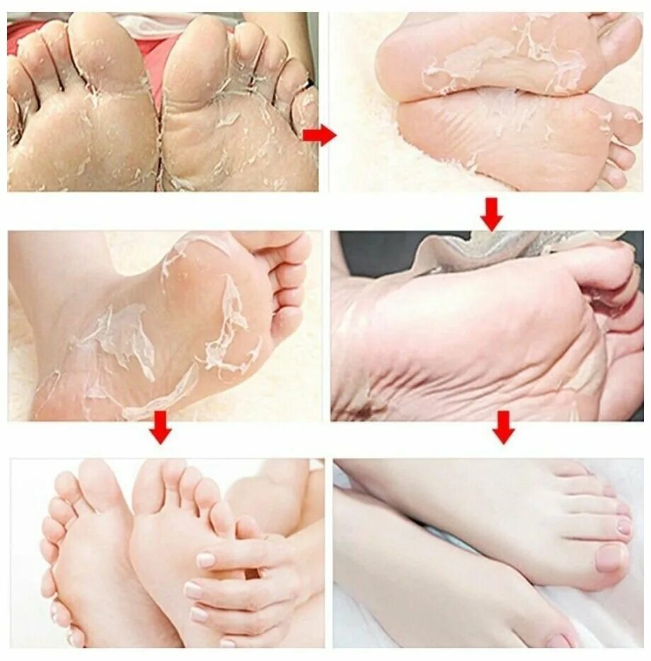 Как использовать носочки. Exfoliating foot Mask маска носки для ног. Пилинг носочки Jigott clean & Moisturizing foot Pack. Маска для ног отшелушивающая Baby foot. Пилинг носочки для педикюра foot Care Mask.