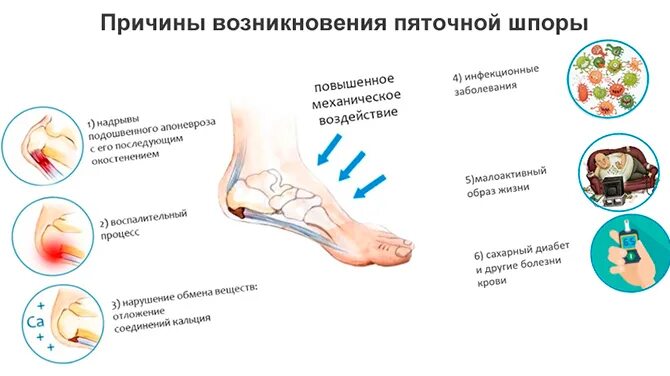 боли в мышцах конечностей