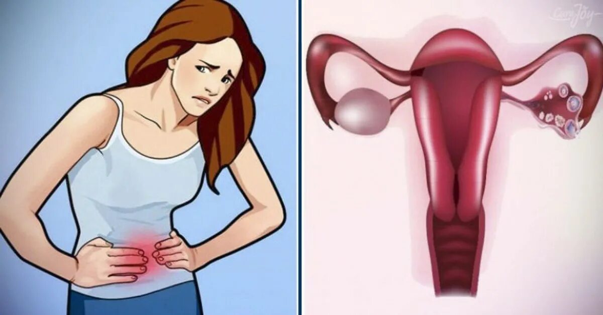 Женщина гинекология. Матка 3д модель. Матка анатомия. Изображение женской репродуктивной системы. Красивая матка.