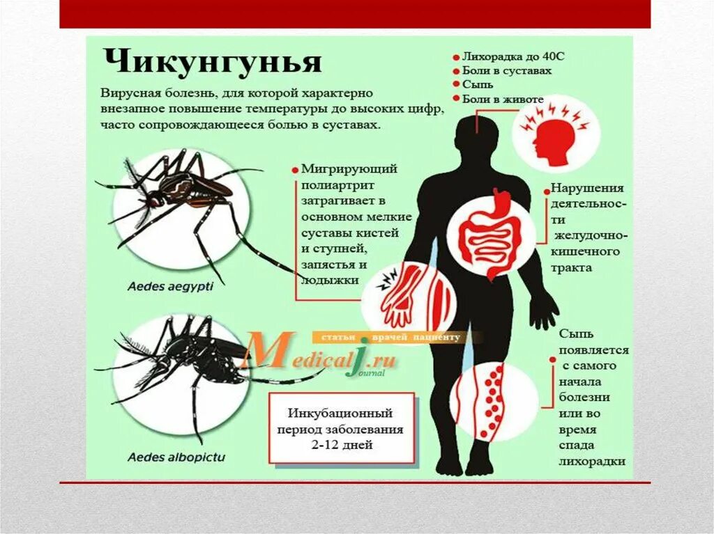 Географическое распространение лихорадки чикунгунья. Лихорадка презентация.