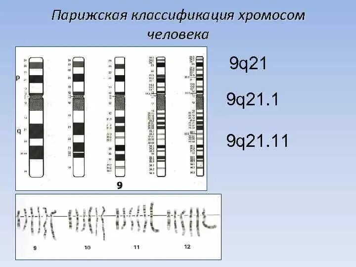 Характеристики хромосом человека. Международная Парижская классификация хромосом человека.. Денверская и Парижская классификация хромосом человека. Классификация хромосом по денверской номенклатуре. Денверская и Парижская номенклатура хромосом.