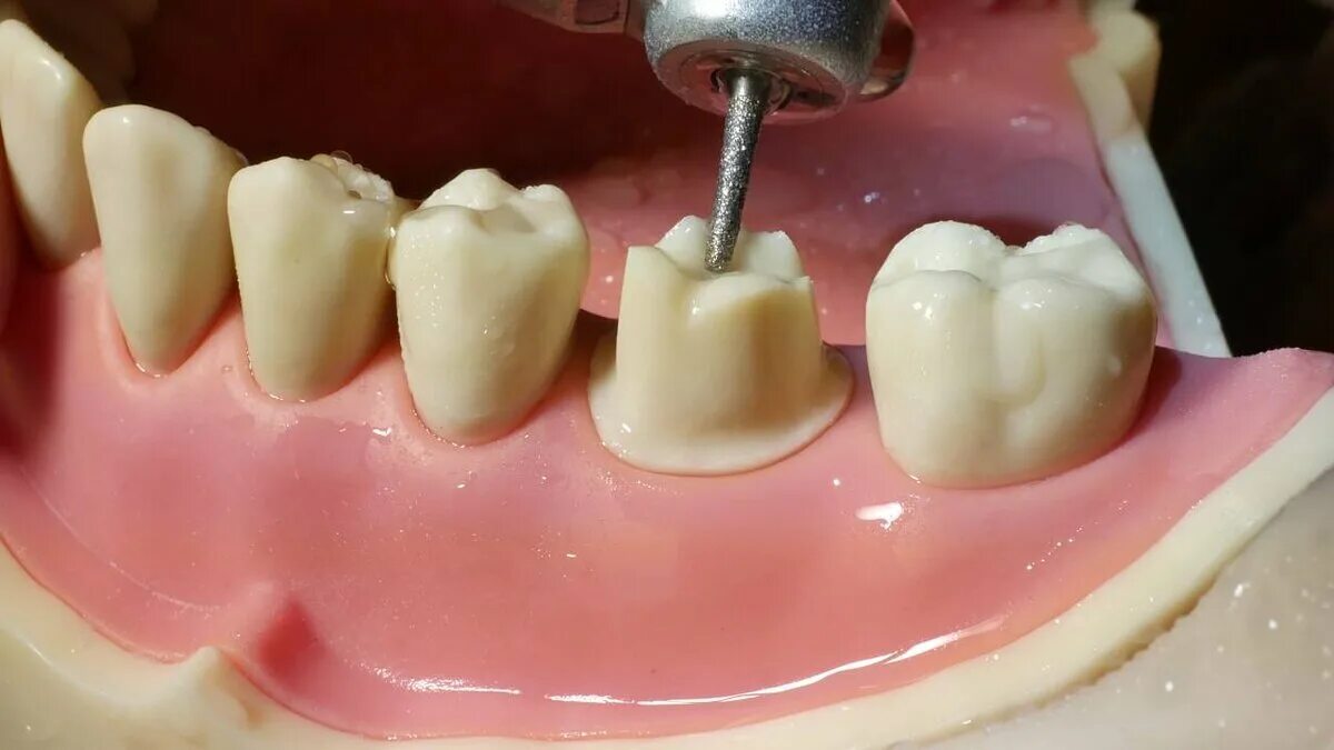 Врач который коронки на зубы называется