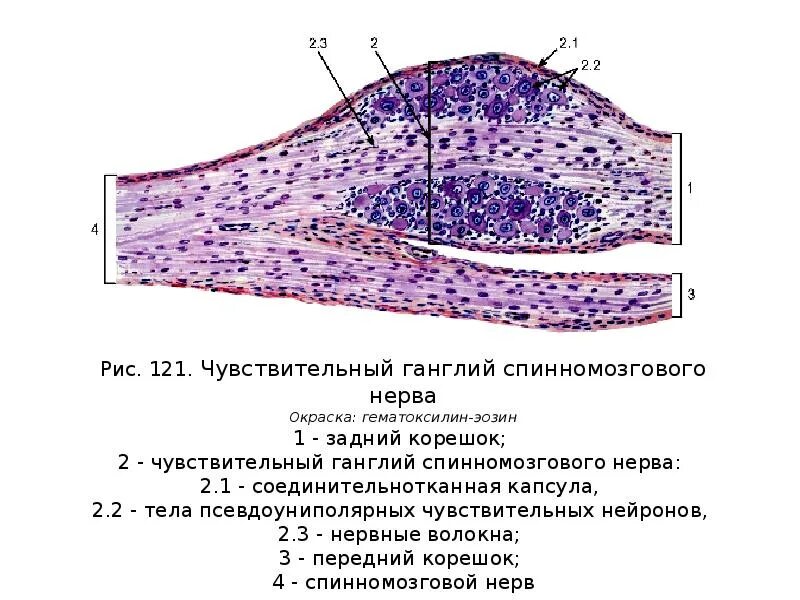 Спинномозговой чувствительный узел