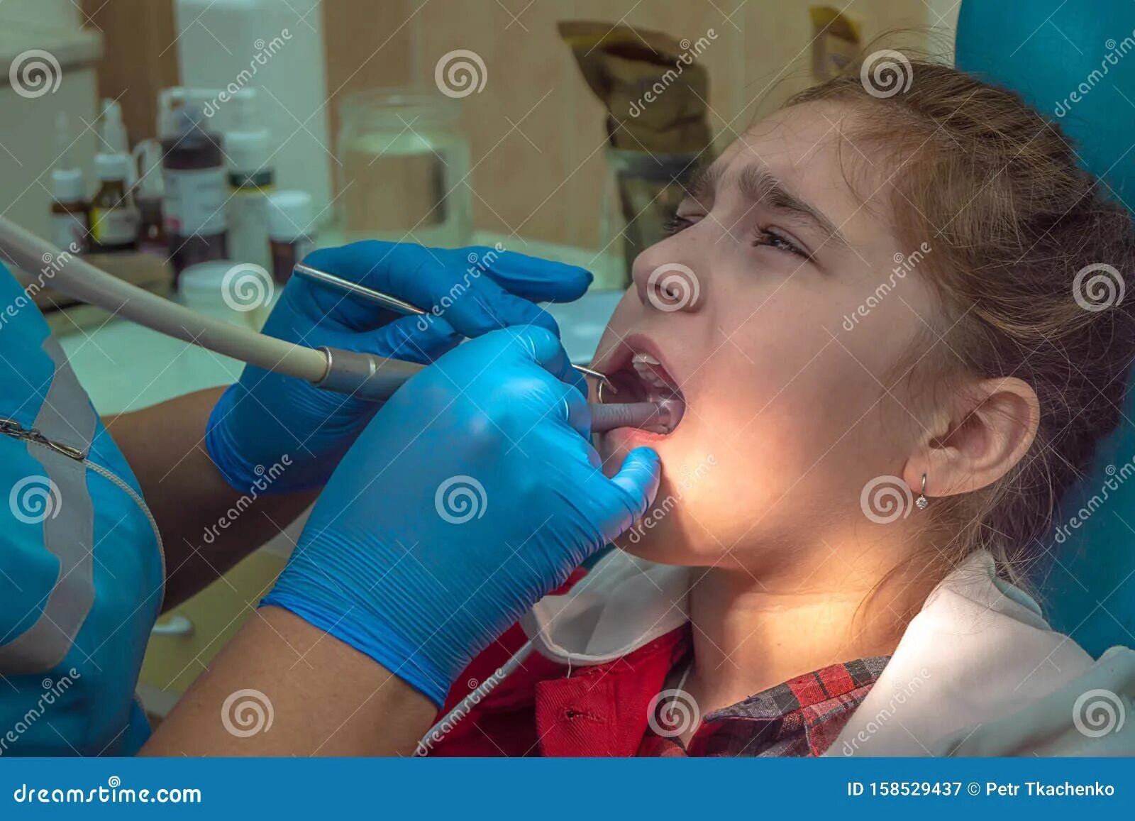 Девочка умерла на приеме у стоматолога. Подросток на приеме у стоматолога. Девушка стоматолог. Девочка у стоматолога. Кресло стоматолога.