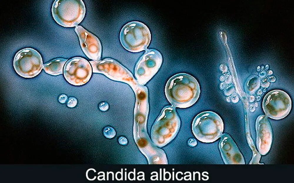 Грибы candida albicans. Дрожжеподобный гриб Candida albicans. Грибок рода кандида под микроскопом. Дрожжеподобными грибами рода Candida.