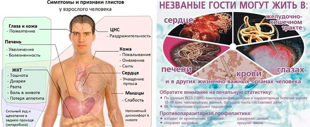Паразиты в организме человека. Детская острица тип червей. Паразитарные заболевания и глистные инвазии. Паразиты черви аскариды. Заболевания вызванные гельминтами у человека.