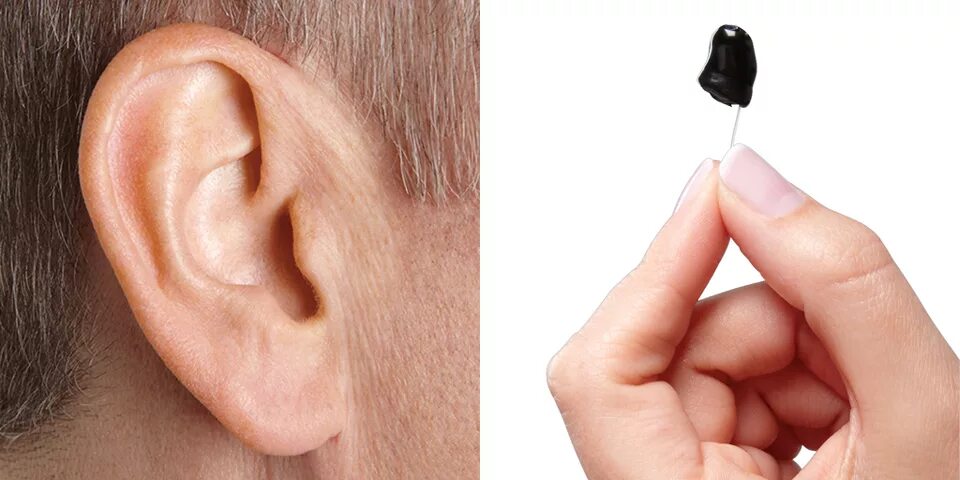 Телефон ухо купить. Глубококанальный слуховой аппарат. Внутриканальный слуховой аппарат невидимый. «Невидимый» слуховой аппарат (IIC). Слуховой аппарат IIC.