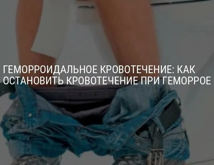 Кровит из заднего прохода у женщины что. Геморрой кровотечение. Геморройное кровотечение как Остановить. Кровотечение при геморро. Кровотечение при геморрое.