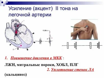Усиление 1 тона