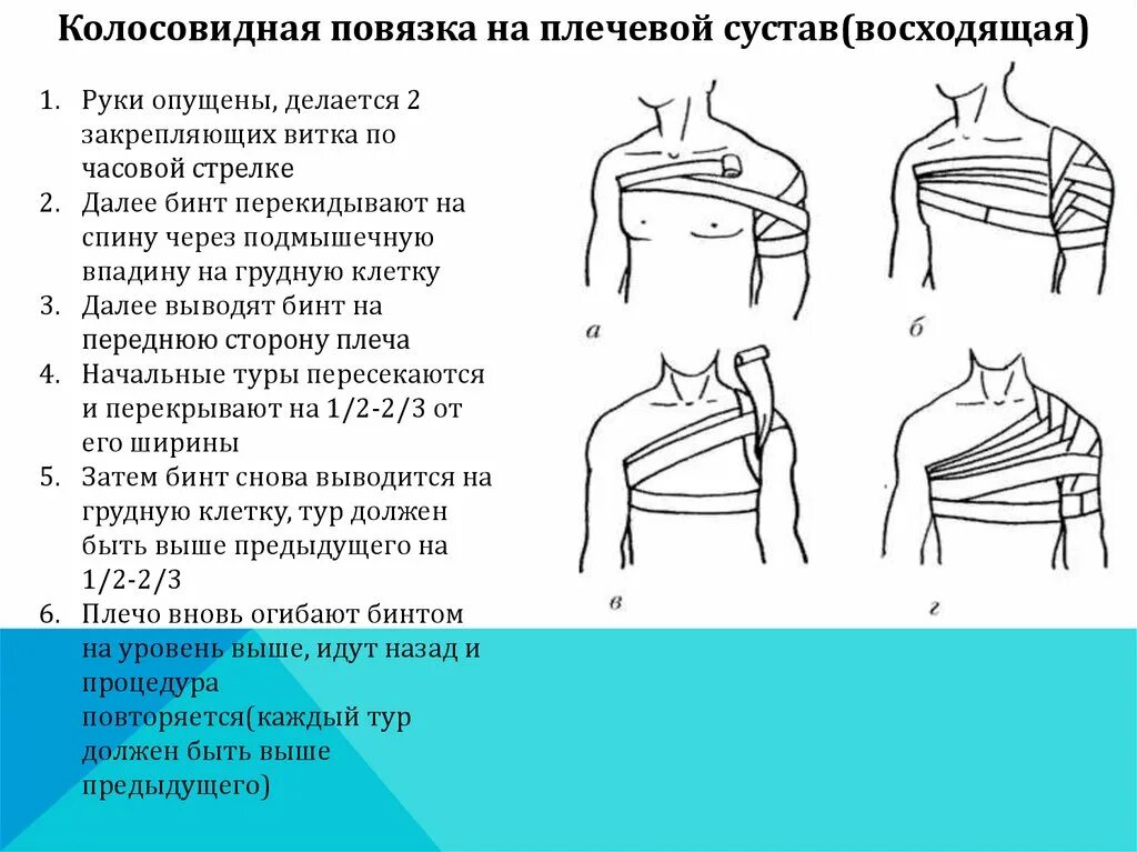 Техника наложения повязки на плечо