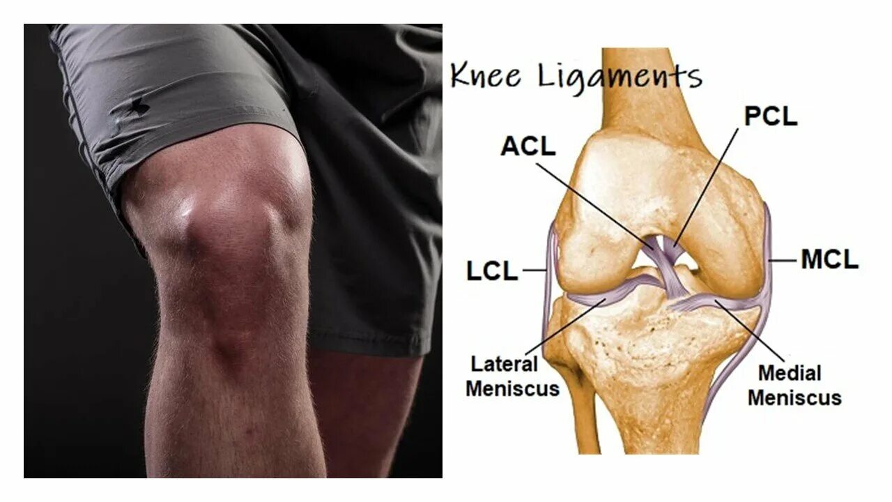 Acl это. Расширенный acl структура. Acl это. Acl это. Обызвествление передней крестообразной связки.