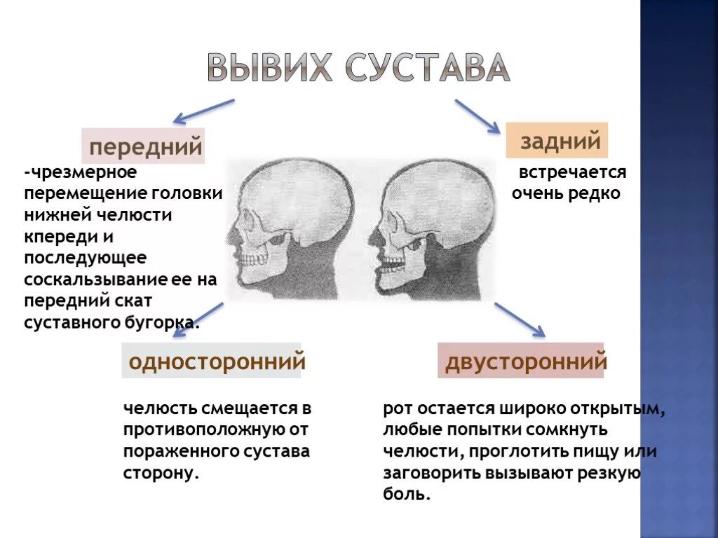 Смещается челюсть
