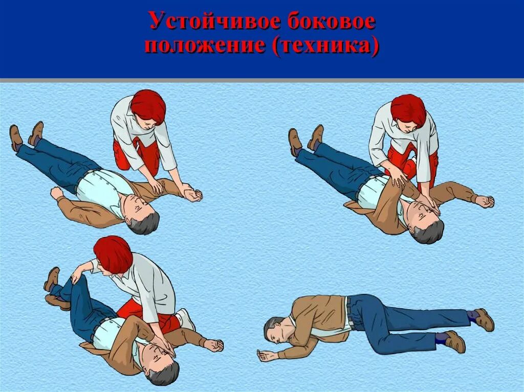 Больному в коме придается положение. Боковое стабильное положение пострадавшего. устойчивое боковое положение пострадавшего. устойчивое боковое положение алгоритм. придание устойчивого бокового положения пострадавшему.