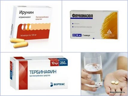 Лечение грибка у женщин препараты
