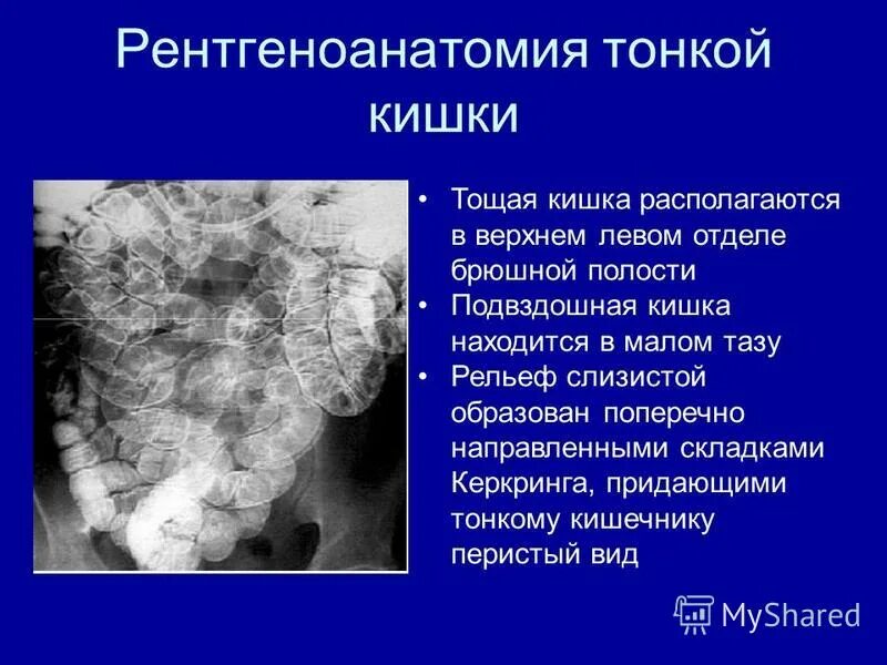 Тяжесть в брюшной полости. Тяжесть в брюшной полости