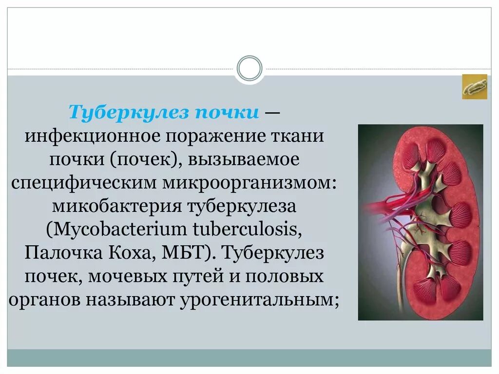 Исход заболеваний почек. Туберкулезное поражение почек. Критерии заболевания туберкулезом почки. Туберкулёз почек и мочевыводящих путей. Туберкулёз мочевыделительной системы.